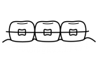 歯列矯正の白黒イラスト