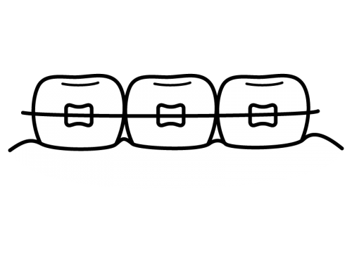 歯列矯正の白黒イラスト